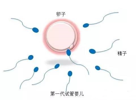 单身生育力保存